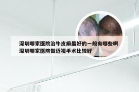 深圳哪家医院治牛皮癣最好的一般有哪些啊 深圳哪家医院做近视手术比较好