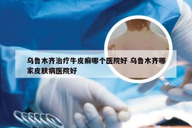 乌鲁木齐治疗牛皮癣哪个医院好 乌鲁木齐哪家皮肤病医院好