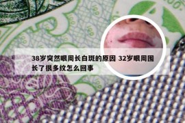 38岁突然眼周长白斑的原因 32岁眼周围长了很多纹怎么回事