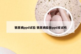 银屑病ppd试验 银屑病能做ppd皮试吗