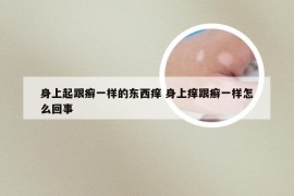 身上起跟癣一样的东西痒 身上痒跟癣一样怎么回事