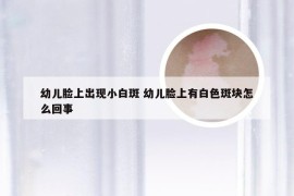 幼儿脸上出现小白斑 幼儿脸上有白色斑块怎么回事