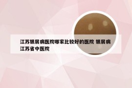 江苏银屑病医院哪家比较好的医院 银屑病 江苏省中医院