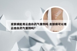 皮肤病能用云南白药气雾剂吗 皮肤痒可以用云南白药气雾剂吗?