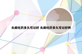 头癣吃药多久可以好 头癣吃药多久可以好啊