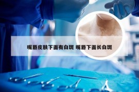 嘴唇皮肤下面有白斑 嘴唇下面长白斑