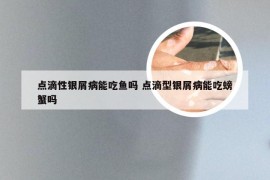 点滴性银屑病能吃鱼吗 点滴型银屑病能吃螃蟹吗