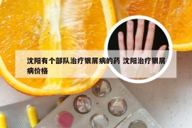 沈阳有个部队治疗银屑病的药 沈阳治疗银屑病价格