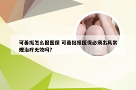 可善挺怎么报医保 可善挺报医保必须出具常规治疗无效吗?