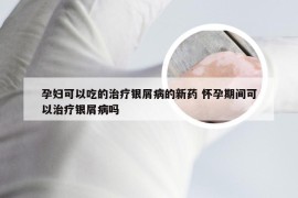 孕妇可以吃的治疗银屑病的新药 怀孕期间可以治疗银屑病吗