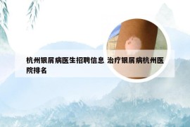 杭州银屑病医生招聘信息 治疗银屑病杭州医院排名