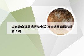 山东济南银屑病医院电话 济南银屑病医院改名了吗