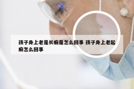 孩子身上老是长癣是怎么回事 孩子身上老起癣怎么回事