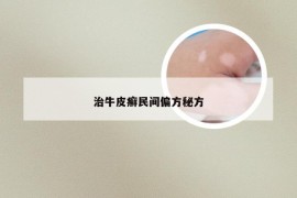 治牛皮癣民间偏方秘方