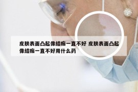 皮肤表面凸起像结痂一直不好 皮肤表面凸起像结痂一直不好用什么药