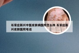 石家庄新兴中医皮肤病医院怎么样 石家庄新兴皮肤医院电话