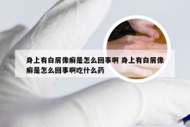 身上有白屑像癣是怎么回事啊 身上有白屑像癣是怎么回事啊吃什么药