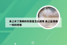 身上长了像癣的东西是怎么回事 身上起像癣一样的疙瘩