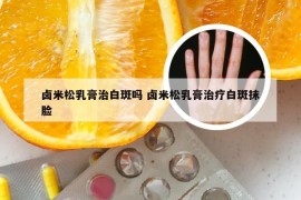 卤米松乳膏治白斑吗 卤米松乳膏治疗白斑抹脸