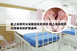 脸上白斑可以涂氟轻松软膏吗 脸上有白斑可以用美白的护肤品吗