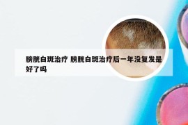 膀胱白斑治疗 膀胱白斑治疗后一年没复发是好了吗