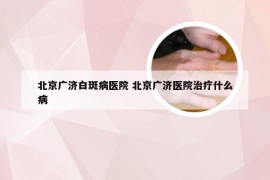 北京广济白斑病医院 北京广济医院治疗什么病