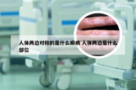 人体两边对称的是什么癣病 人体两边是什么部位