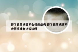 得了银屑病是不会得癌症吗 得了银屑病就不会得癌症有这说法吗