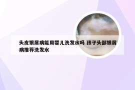 头皮银屑病能用婴儿洗发水吗 孩子头部银屑病推荐洗发水