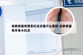 皮肤表面有很多红点点是什么原因 皮肤表面有许多小红点