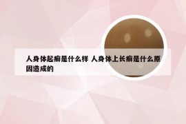 人身体起癣是什么样 人身体上长癣是什么原因造成的