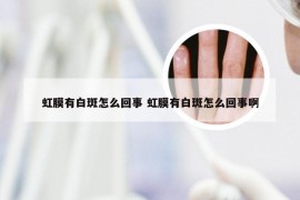 虹膜有白斑怎么回事 虹膜有白斑怎么回事啊