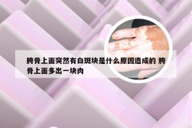 胯骨上面突然有白斑块是什么原因造成的 胯骨上面多出一块肉