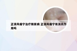 正清风痛宁治疗银屑病 正清风痛宁有消炎作用吗