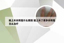 腿上长白斑是什么原因 腿上长了很多白斑是怎么治疗