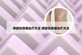 颈部白斑病治疗方法 颈部白斑病治疗方法