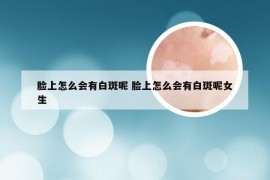 脸上怎么会有白斑呢 脸上怎么会有白斑呢女生