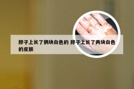 脖子上长了俩块白色的 脖子上长了两块白色的皮肤