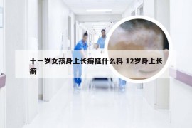 十一岁女孩身上长癣挂什么科 12岁身上长癣