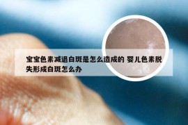 宝宝色素减退白斑是怎么造成的 婴儿色素脱失形成白斑怎么办