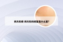 四方形癣 四方形的螃蟹是什么蟹?