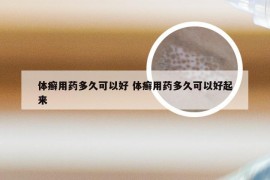 体癣用药多久可以好 体癣用药多久可以好起来