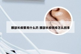 腰部长癣要用什么药 腰部长癣很痒怎么回事