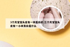 3个月宝宝头皮有一块是白的 三个月宝宝头皮有一小块发白是什么