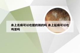 身上出癣可以吃醒的辣的吗 身上起癣可以吃鸡蛋吗