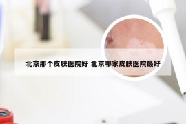 北京那个皮肤医院好 北京哪家皮肤医院最好