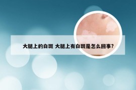 大腿上的白斑 大腿上有白斑是怎么回事?