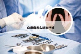 白癫疯怎么能治疗好