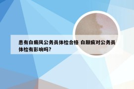 患有白癜风公务员体检合格 白颠疯对公务员体检有影响吗?