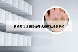 头癣可以抹氟轻松吗 头癣可以擦碘伏吗